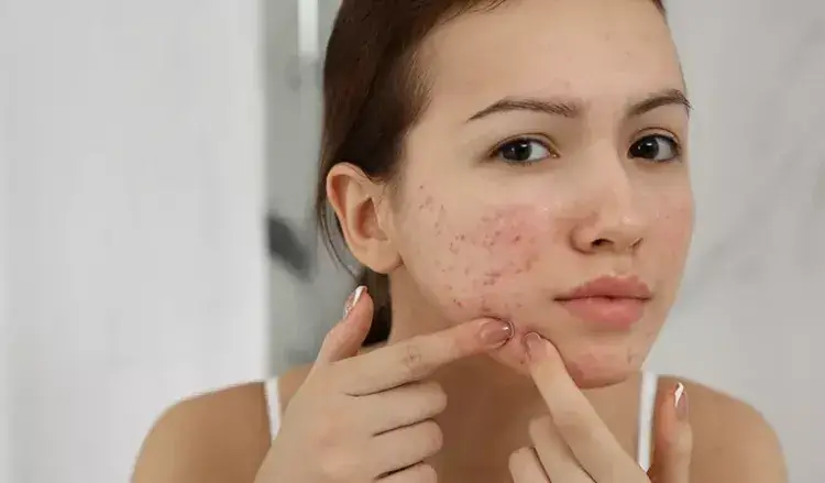 Can a Home Blue Light Acne Remover Effectively Clear Acne? 